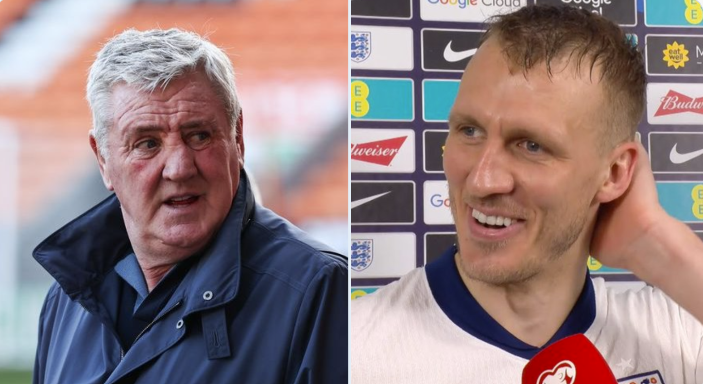 Embarrassing from journalists on Dan Burn and Steve Bruce - Revisionism at its finest!